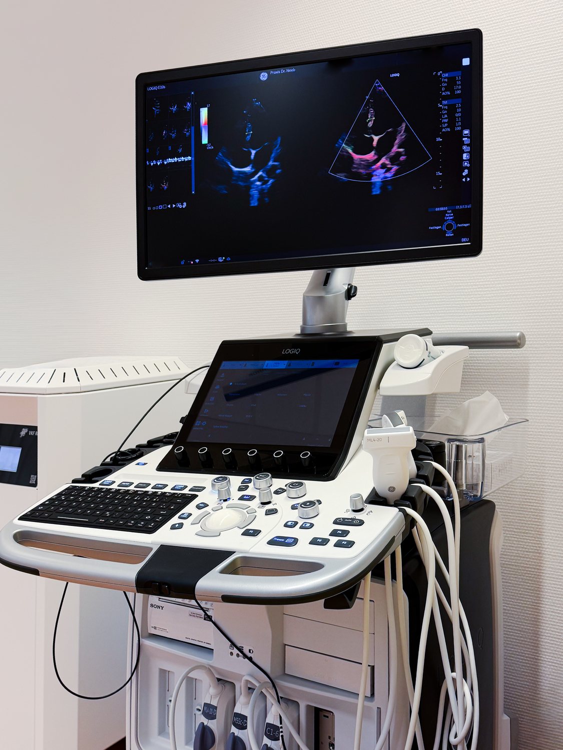 Das Ultraschallger&auml;t LOGIQ E10s mit Bedienkonsole, Sonden und einem Echokardiographiebild auf dem Monitor